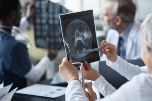 A group of doctors examining an x-ray related to a traumatic brain injury, discussing findings and treatment options.